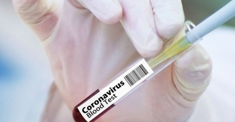В Украине заболеваемость коронавирусом снизилась: подтверждено 12,7 тысяч случаев COVID-19