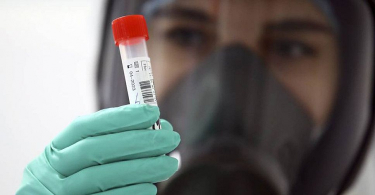 На КПВВ «Новотроицкое» на Донетчине около ста человек сдали тест на антиген коронавируса