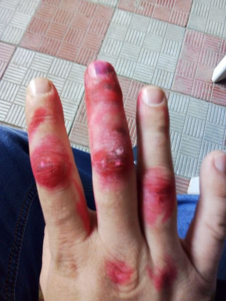 Живодер из Мариуполя напал на медиков скорой помощи (ФОТО 18+)