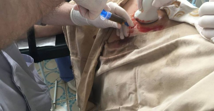 Мариупольские хирурги и гинекологи провели уникальную операцию беременной (ФОТО)