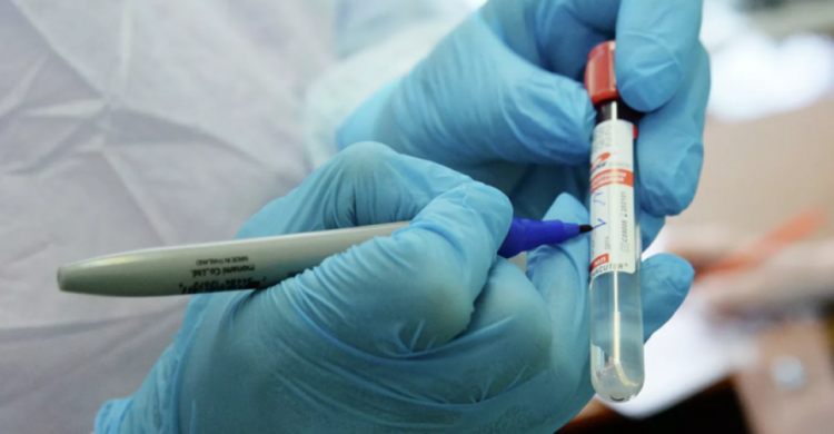 В Украине выявили свыше 10 тысяч заболевших коронавирусом за сутки