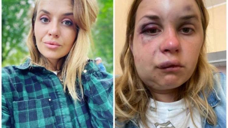 Избитая и едва не изнасилованная в поезде «Киев-Мариуполь» женщина получит компенсацию