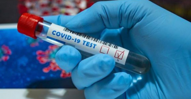 В Украине новый антирекорд по заболеванию коронавирусом