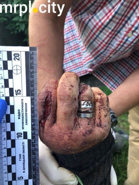 В Мариуполе жестоко убили мужчину, нанеся 7 ударов топором по голове (ФОТО 18+)