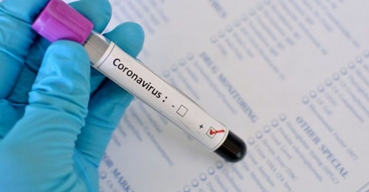 В Украине количество подтвержденных случаев коронавируса превысило 150