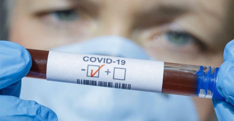 В Украине от COVID-19 умерли еще 33 пациента: трое из них – на Донетчине
