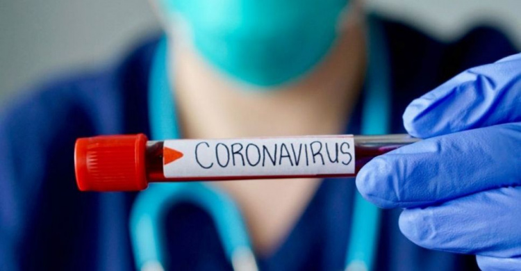 В Украине количество заболевших COVID-19 превысило 22 тысячи. За сутки умерло 11 человек