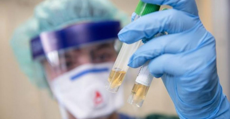 В Мариуполе 62 лабораторно подтвержденных случаев заболевания коронавирусом