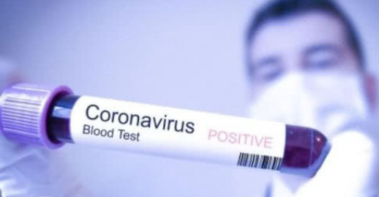 В Украине коронавирус побил рекорд: более 2 300 случаев за сутки