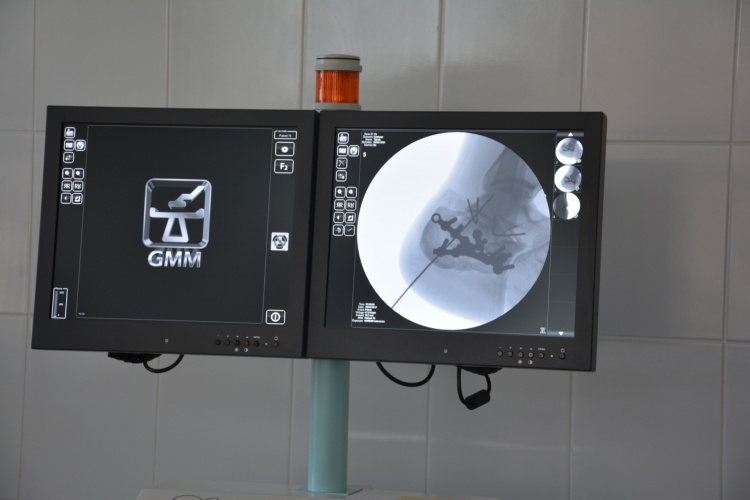 В еще одной больнице Мариуполя установили современное оборудование (ФОТО)