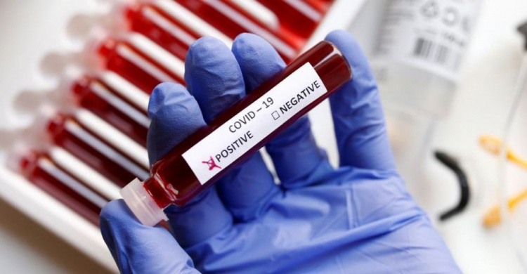 В Мариуполе два новых случая коронавируса. Среди заболевших – 9-летний ребенок