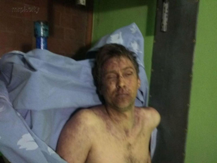 В больнице Мариуполя умер неизвестный мужчина. Полиция просит помощи в опознании (ФОТО 18+)