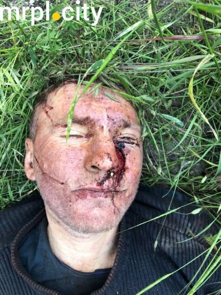 В Мариуполе жестоко убили мужчину, нанеся 7 ударов топором по голове (ФОТО 18+)