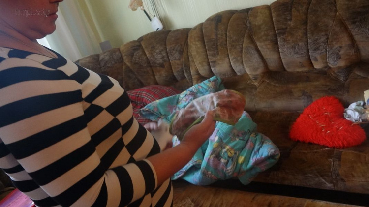 В Мариуполе на трехлетнюю девочку напала крыса (ФОТО+ДОПОЛНЕНО)