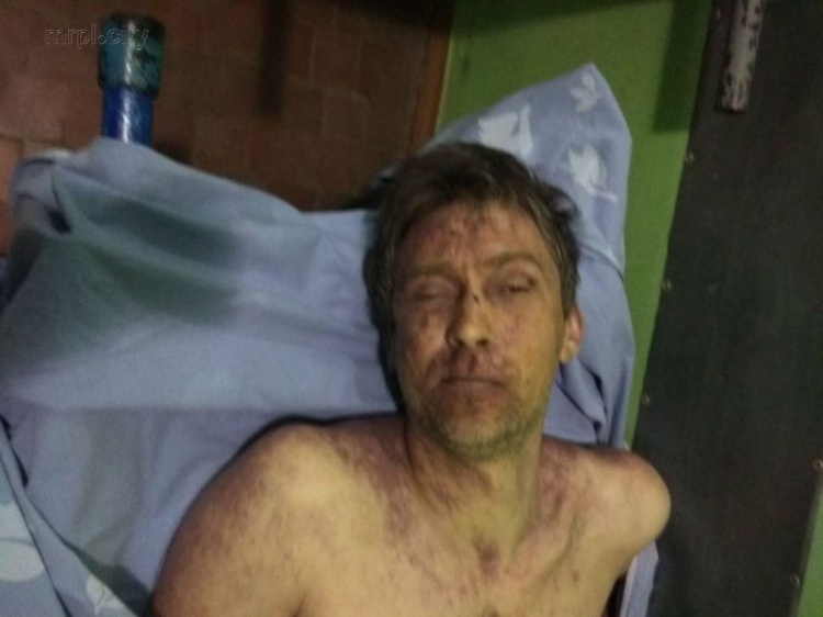 В больнице Мариуполя умер неизвестный мужчина. Полиция просит помощи в опознании (ФОТО 18+)
